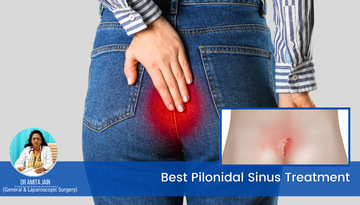 Best Pilonidal Sinus Treatment by Dr Amita Jain